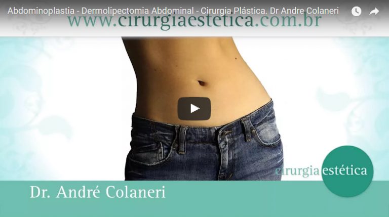 Abdominoplastia - Dermolipectomia Abdominal - Cirurgia Plástica