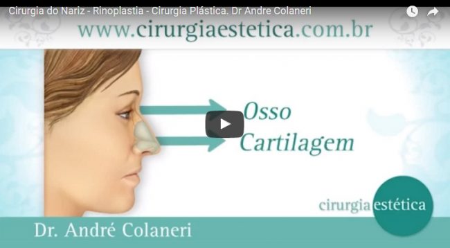 Cirurgia do Nariz – Rinoplastia – Cirurgia Plástica