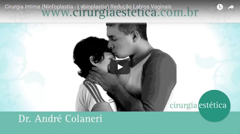Cirurgia Intima (Ninfoplastia – Labioplastia) Redução Labios Vaginais