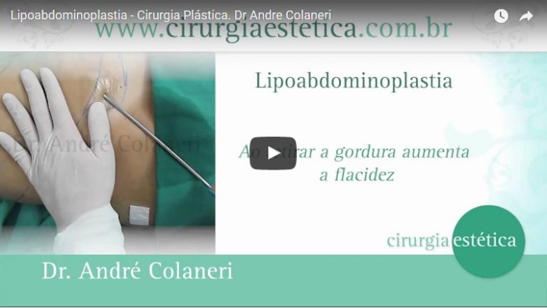 Lipo-abdominoplastia – Cirurgia Plástica
