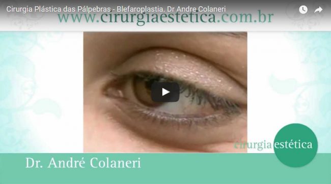 Cirurgia Plástica das Pálpebras – Blefaroplastia