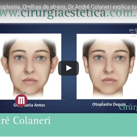 Cirurgia Plástica: Otoplastia, Orelhas de abano