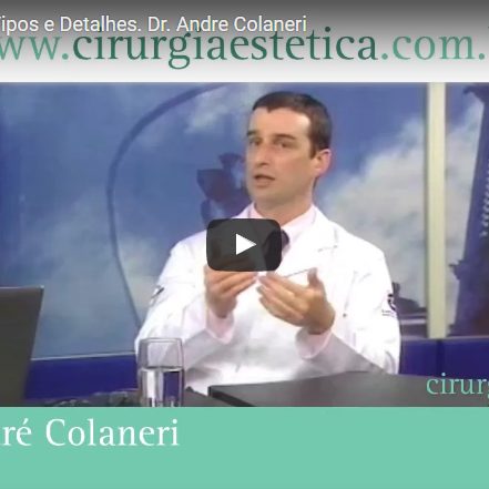 Cirurgias Intimas : Tipos e Detalhes