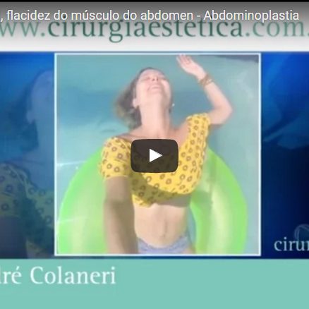 Diastase Abdominal, flacidez do músculo do abdômen – Abdominoplastia