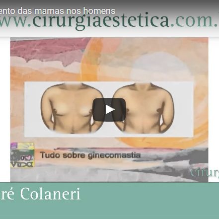 Ginecomastia, aumento das mamas nos homens