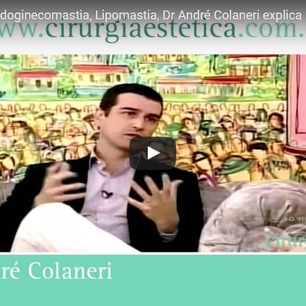 Ginecomastia, Pseudoginecomastia, Lipomastia, Dr André Colaneri explica