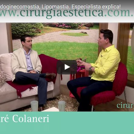Ginecomastia, Pseudoginecomastia, Lipomastia. Especialista explica!