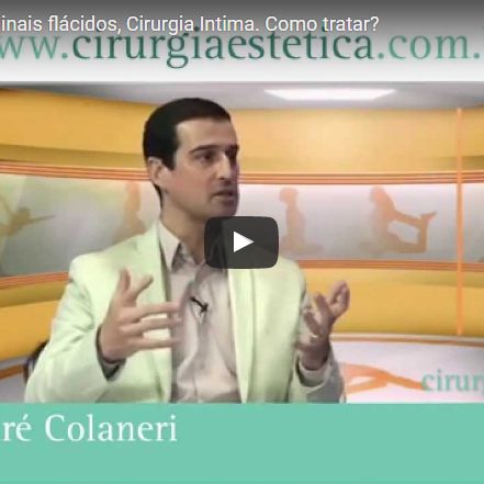 Grandes Lábios Vaginais flácidos, Cirurgia Intima. Como tratar?