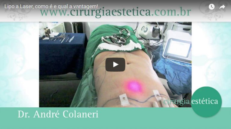 Lipo a Laser, como é e qual a vantagem!