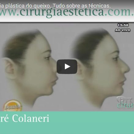 Mentoplastia, cirurgia plástica do queixo. Tudo sobre as técnicas.