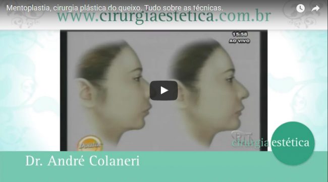 Mentoplastia, cirurgia plástica do queixo. Tudo sobre as técnicas.