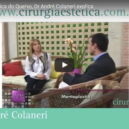 Mentoplastia – Plastica do Queixo