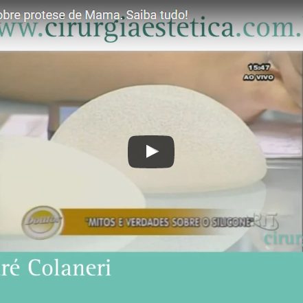 Mitos e Verdades sobre prótese de Mama. Saiba tudo!