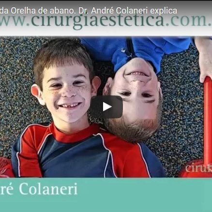 Otoplastia, Cirurgia da Orelha de abano