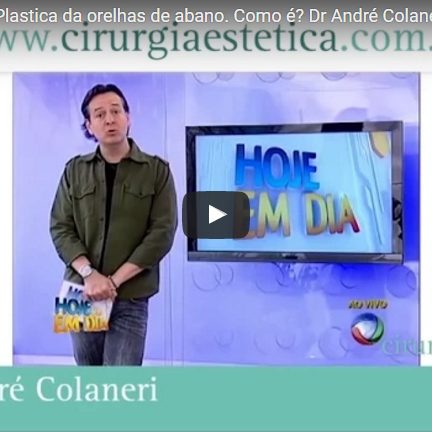 Otoplastia, Cirurgia Plastica da orelhas de abano. Como é?