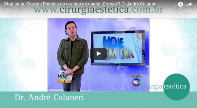 Otoplastia, Cirurgia Plastica da orelhas de abano. Como é?