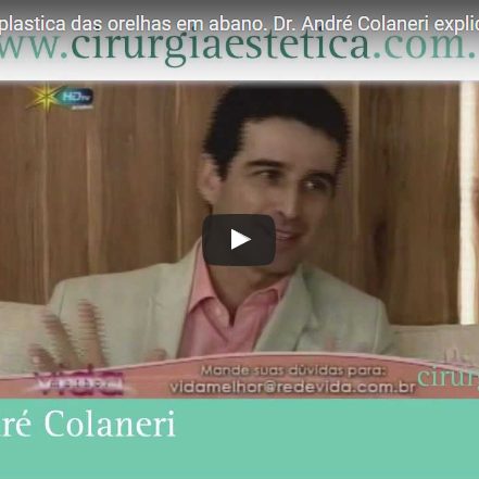 Otoplastia, Cirurgia plastica das orelhas em abano