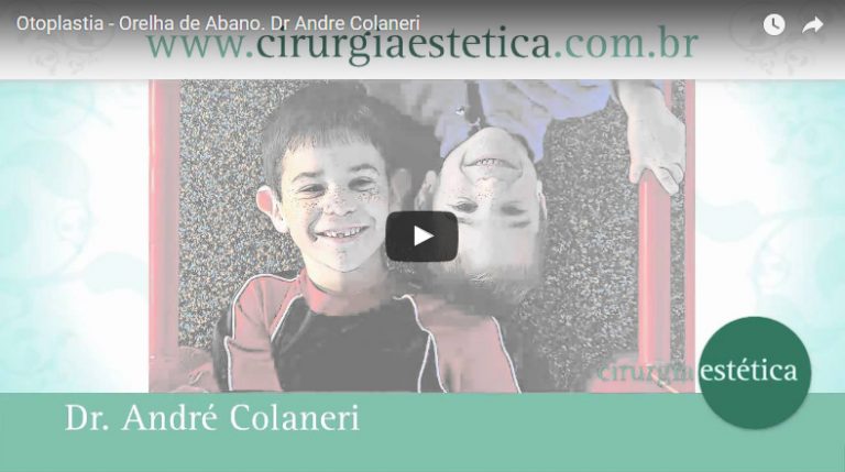 Otoplastia – Orelha de Abano