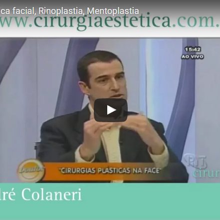 Perfiloplastia, Plástica facial, Rinoplastia, Mentoplastia