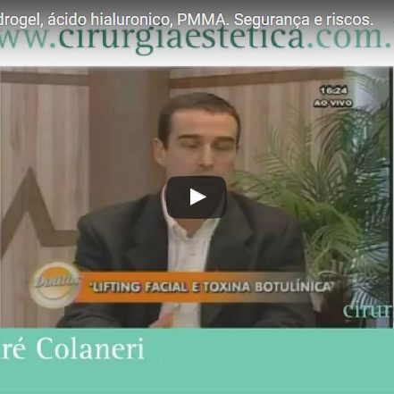 Preenchimentos: hidrogel, ácido hialurônico, PMMA. Segurança e riscos.