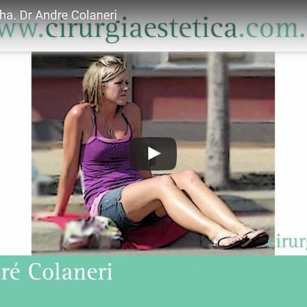 Prótese de Panturrilha