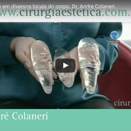 Próteses de Silicone em diversos locais do corpo