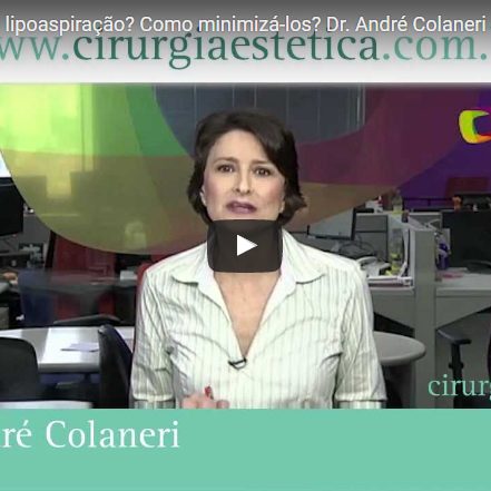 Qual o risco de uma lipoaspiração? Como minimizá-los?