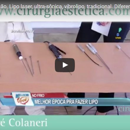 Tipos de lipoaspiração. Lipo laser, ultra-sônica, vibrolipo, tradicional. Diferenças.