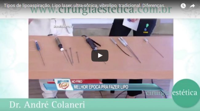 Tipos de lipoaspiração. Lipo laser, ultra-sônica, vibrolipo, tradicional. Diferenças.