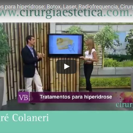 Tipos de tratamentos para hiperidrose: Botox, Laser, Radiofrequência, Cirurgia