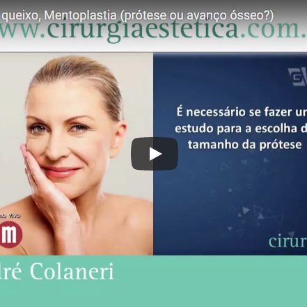 Cirurgia plástica do queixo - Gazeta