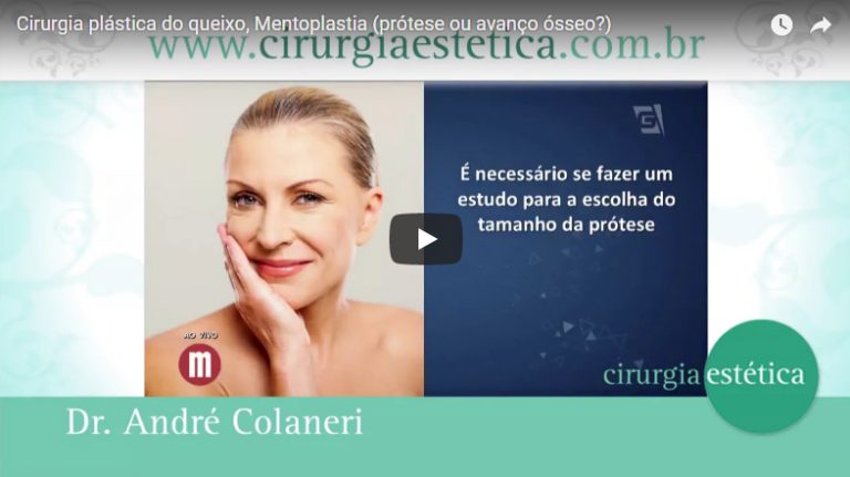 Cirurgia plástica do queixo - Gazeta
