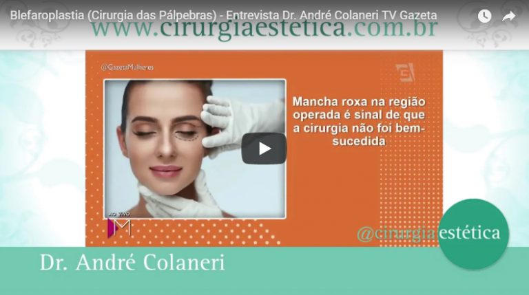 Blefaroplastia (Cirurgia das Pálpebras) - Entrevista Dr. André Colaneri TV Gazeta