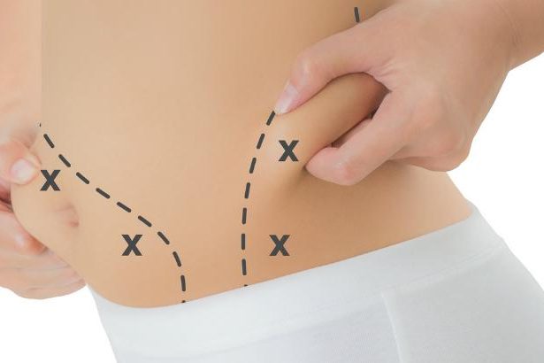 como-diminuir-flacidez-e-gordura-localizada-5