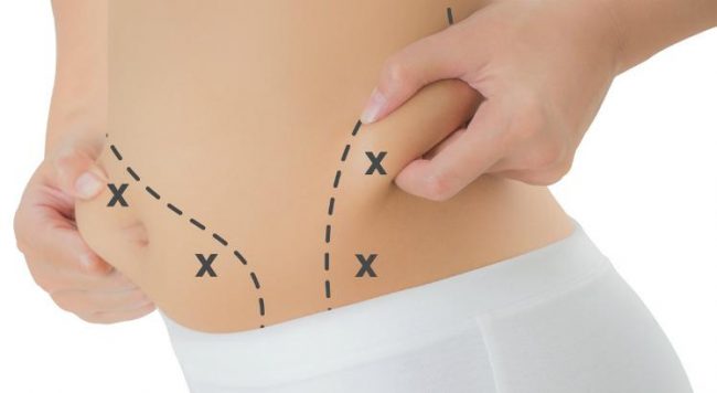 como-diminuir-flacidez-e-gordura-localizada-5