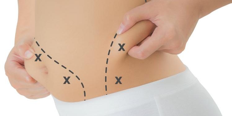 como-diminuir-flacidez-e-gordura-localizada-5