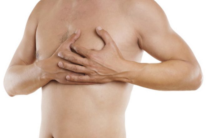 ginecomastia_homem