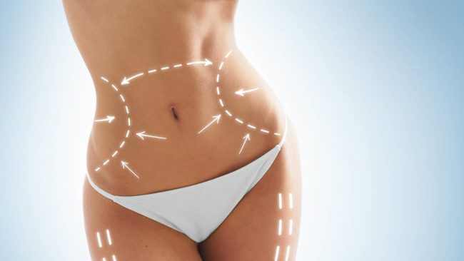 abdominoplastia-barriga-lisinha