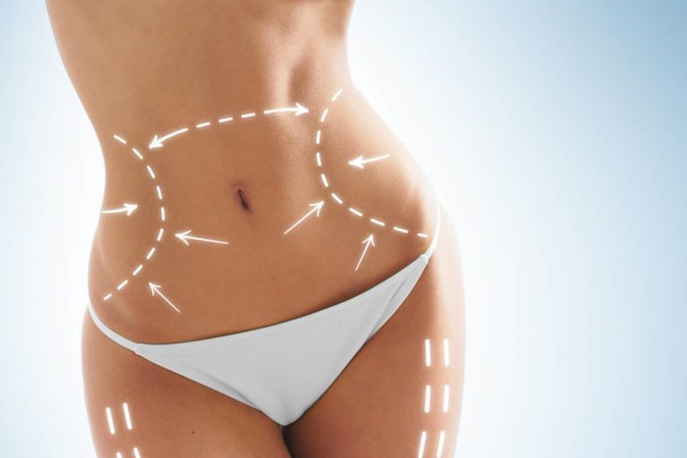 abdominoplastia barriga lisinha