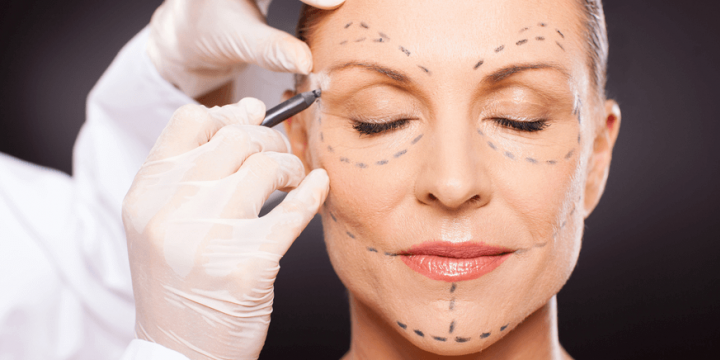 cirurgia-plástica-depois-dos-60-anos cirurgia-plástica-depois-dos-60-anos