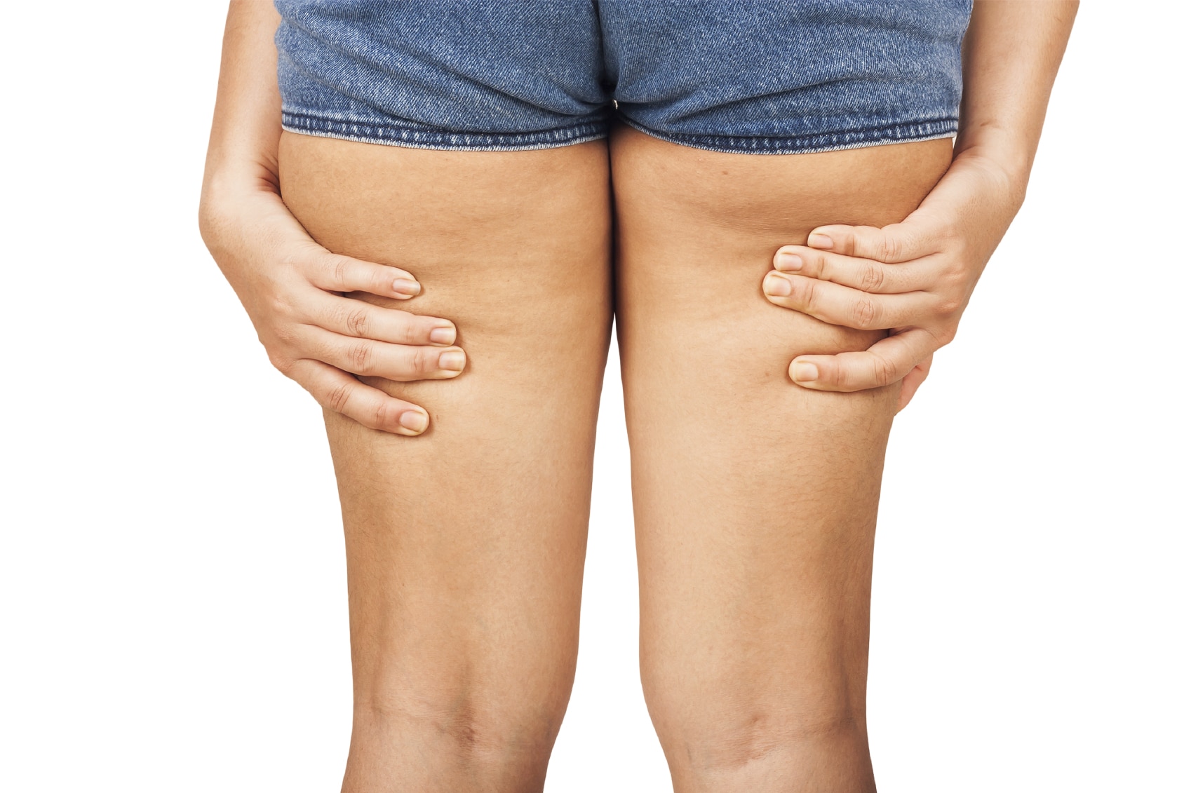 how-to-treat-cellulite-4 