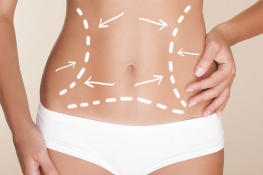 abdominoplastia-riscos-4