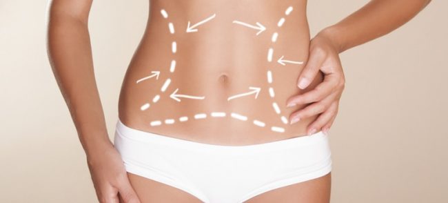 abdominoplastia-riscos-4