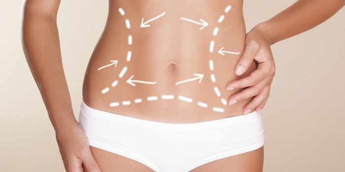 abdominoplastia-riscos-4 abdominoplastia-riscos-4