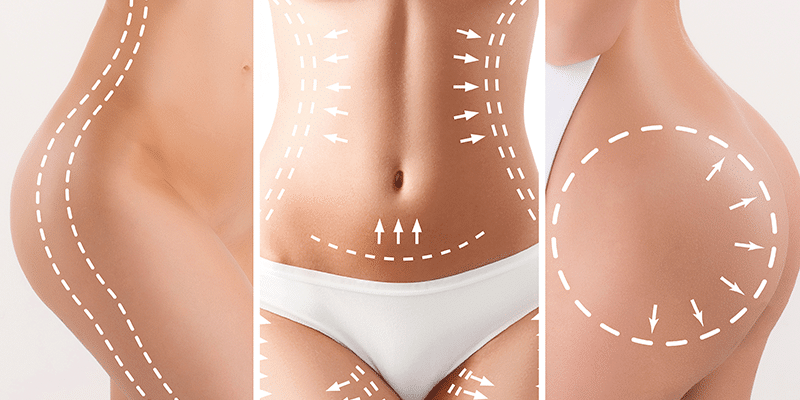 vibrolipo-o-que-é-como-funciona-img-1