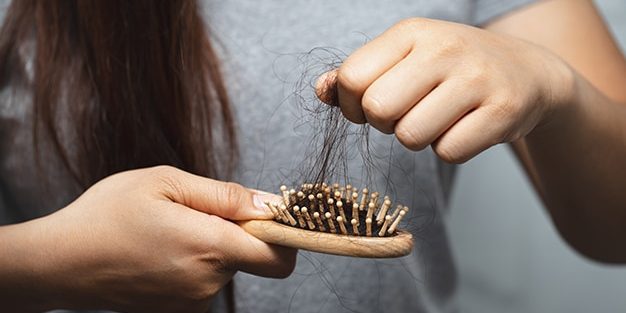 queda-de-cabelo-1 Queda de cabelo: 5 dicas para evitar